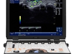 GE NextGen LOGIQ e Ultrasound Machine
