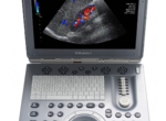 GE Voluson i Ultrasound Machine