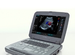 Siemens Acuson P500 Ultrasound Machine